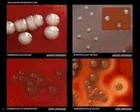 bacteria:hemolysis on blood agar